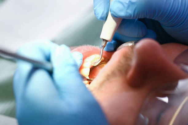 Best 24-Hour Emergency Dentist in Roanoke, TX