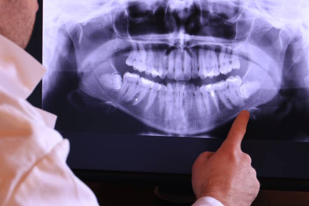 Best Mobile Emergency Dentist in Roanoke, TX